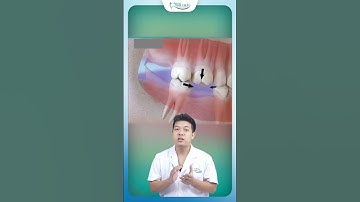 Những Tác Hại Nguy Hiểm Nhất Khi Mất Răng Lâu Ngày | Nha Khoa Minh Châu