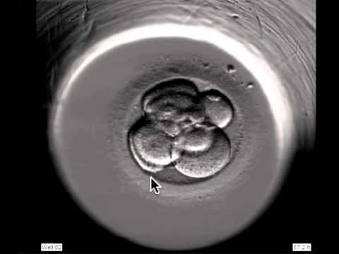 Thumbnail for the embedded element "ivf embryo developing over 5 days by fertility Dr Raewyn Teirney"