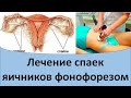 Лечение спаек яичников фонофорезом