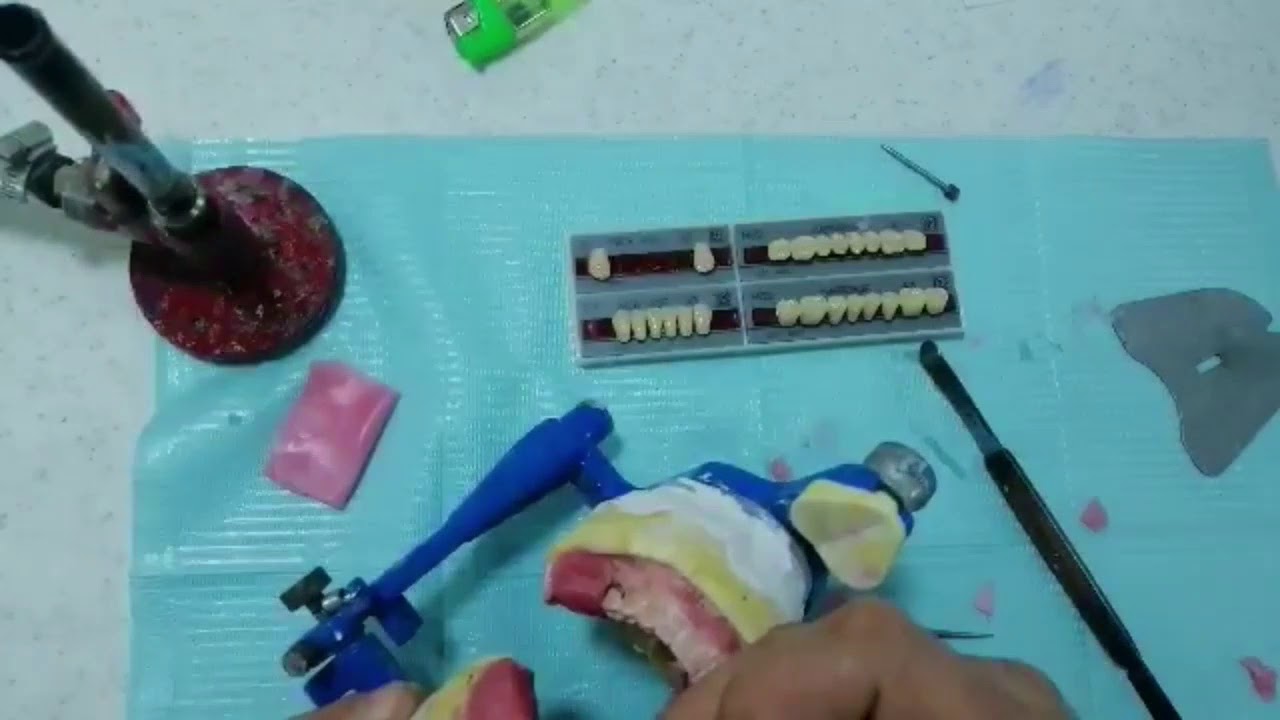 المرحلة (4) التأصيل العلمي تنضيد الأسنان teeth setting أ. عمار الجهماني