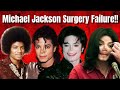 Michael jackson plastic surgery failure  michael jackson face transformation