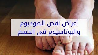 أعراض نقص الصوديوم والبوتاسيوم في الجسم