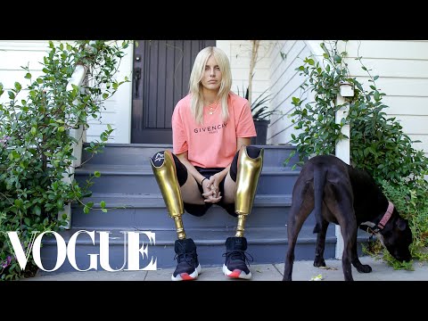 Video: Beauty With A Disfigured Leg Became A Supermodel