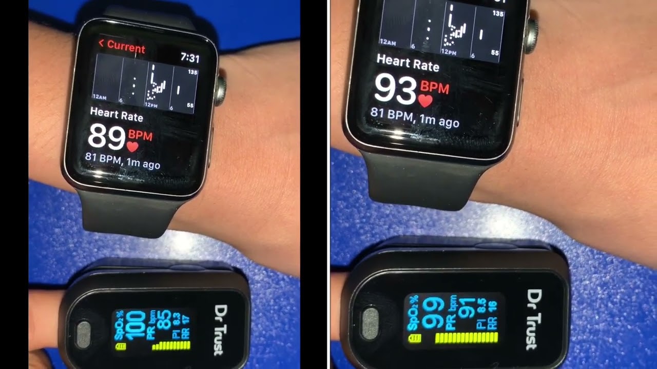 Monitoring heart rate with Apple Watch & Dr Trust PULSE Oximeter