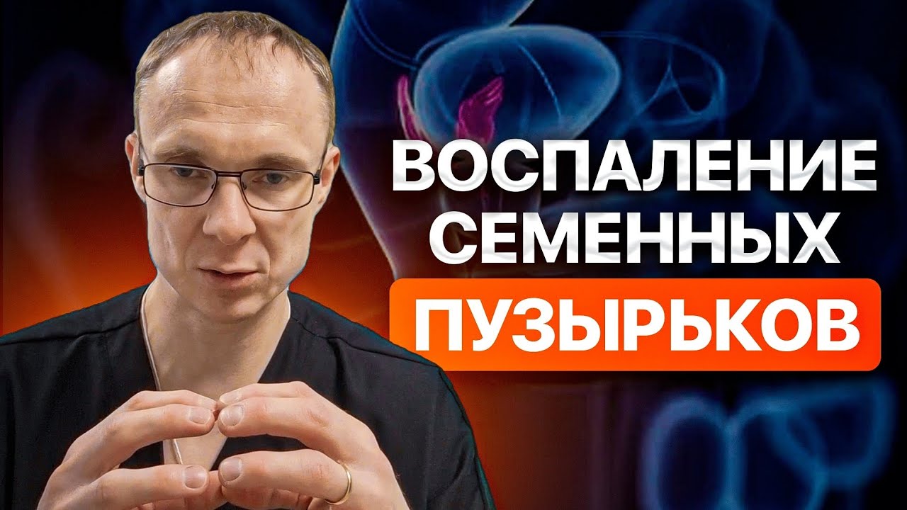 Воспаление семенных пузырьков. Везикулит. Врач уролог-андролог. Москва.