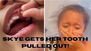 SKYE GETS HER TOOTH PULLED OUT!!