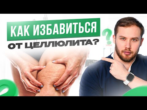 Вот почему появляется ЦЕЛЛЮЛИТ: 4 малоизвестных фактора + как от него избавиться