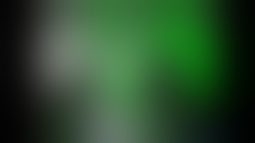 Robotic Cholecystectomy ICG Firefly demo