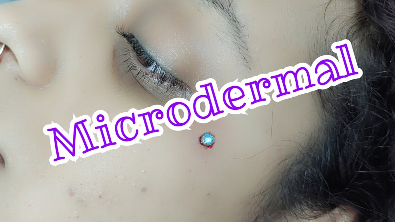 Microdermal Piercing