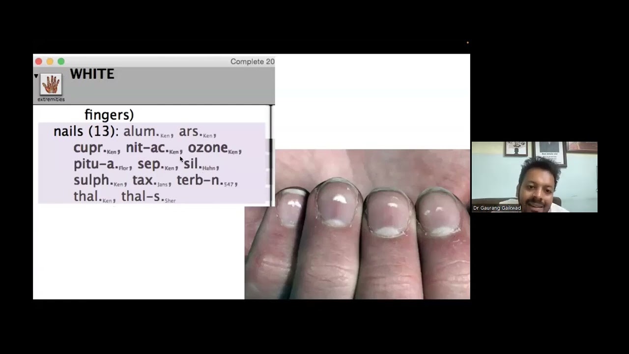 Hands, feet, nails- Observation