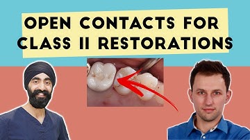 STOP Getting Open Contacts on Your Class II Restorations - GF008