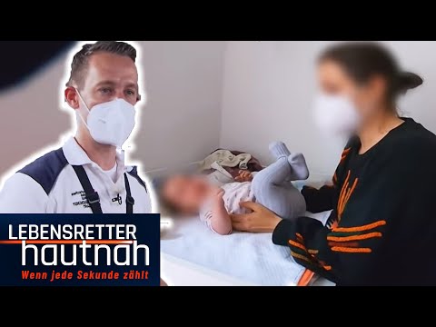 Video: Baby-Haut-Probleme? Wie man allgemeine Beanstandungen findet