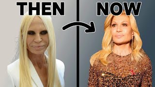 Donatella Versace's Transformation | - A Cosmetic Doctor's Expert Analysis