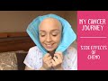 My Cancer Journey: Tips for Coping with Chemo Side Effects