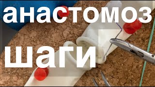 видео: анастомоз в 3 шага / как тренировать лапароскопический анастомоз / laparoscopic anastomosis tutorial картинка: анастомоз в 3 шага / как тренировать лапароскопический анастомоз / laparoscopic anastomosis tutorial