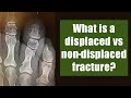 What is a displaced vs nondisplaced fracture