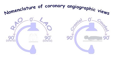 Coronary angiography. Lesson 2: nomenclature of coronary angiographic views