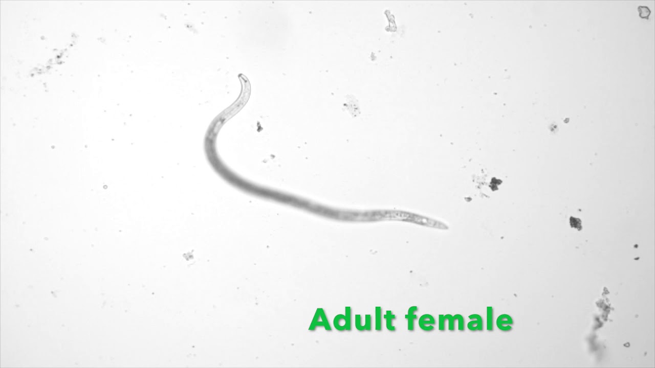 Pratylenchus aka Root Lesion Nematode (10x magnification) - YouTube