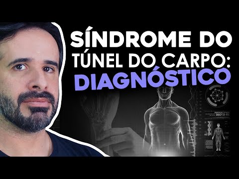 ASSIM VOCÊ SABERÁ COMO DIAGNOSTICAR UMA SÍNDROME DO TÚNEL DO CARPO.