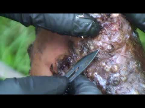 Jigger Digging Douglas - thick jigger clusters/colonies (1 of 2)