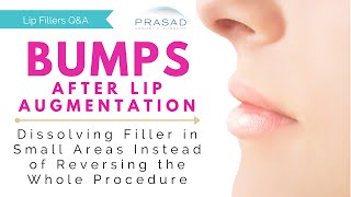 Bumps after Lip Augmentation - Dissolving Filler in a Small, Focused Area