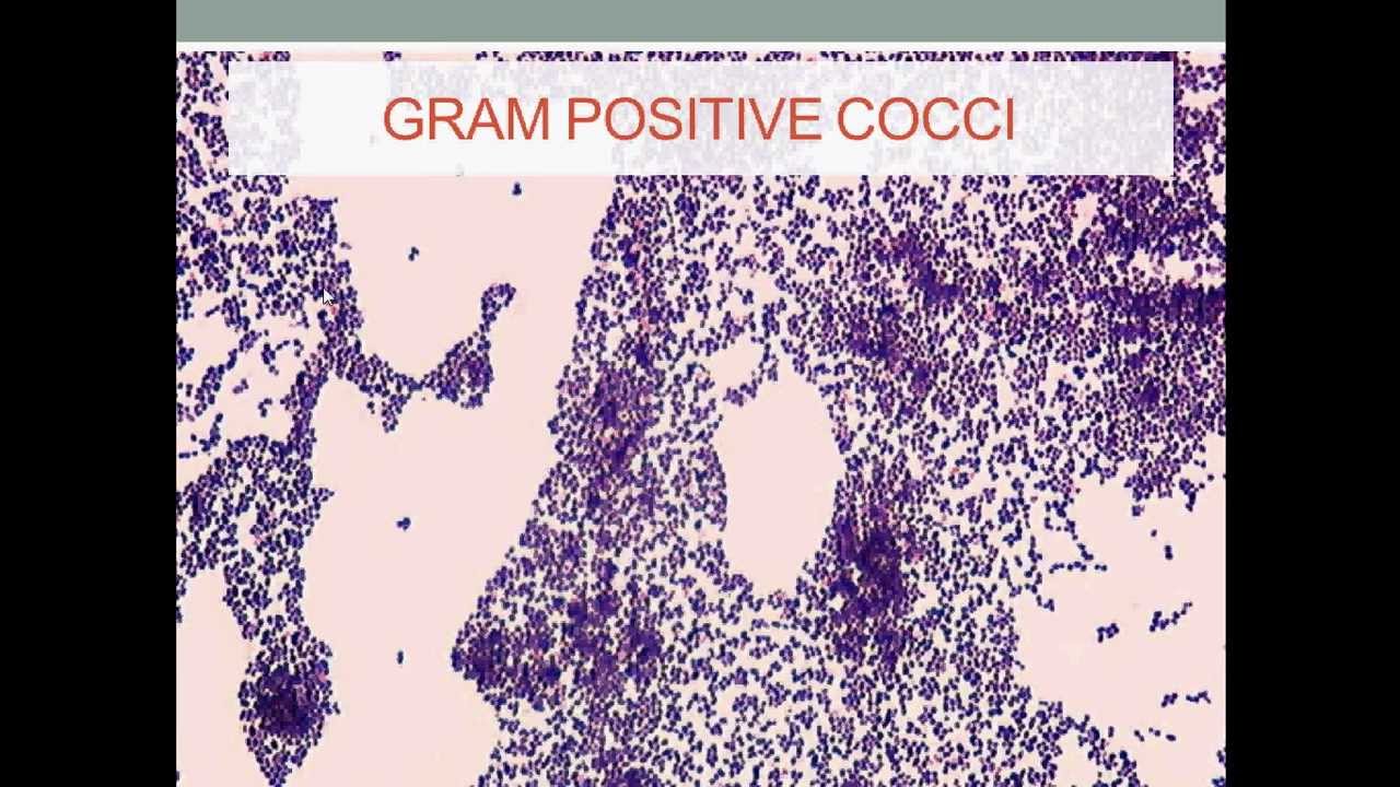 staphylococcus epidermidis gram stain