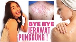 CARA MENGHILANGKAN JERAWAT PUNGGUNG | Clarin Hayes - Durasi: 7.40. 