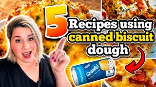 5 INCREDIBLE Ways To Use CANNED BISCUITS That WILL CHANGE Your LIFE!