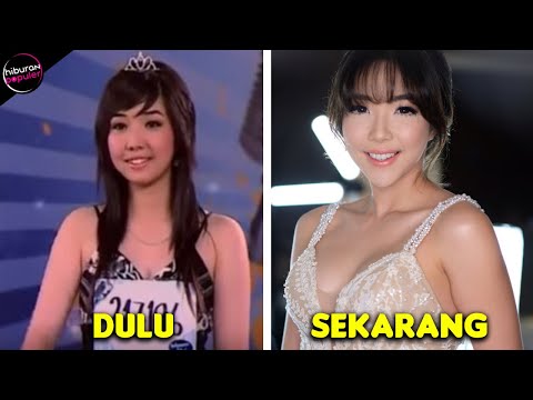 GISEL BERUBAH TOTAL! Begini Transformasi Mengejutkan Artis Sebelum dan Sesudah Veneer Gigi