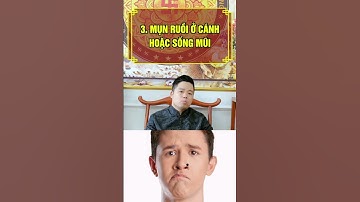 4 nốt ruồi cực xấu cần xoá ngay vì ảnh hưởng tài vận