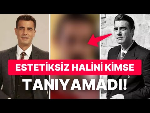 Erdal'ı Tayanç Ayaydın'ın Estetik Yaptırmadan Önceki Hali Ortaya Çıktı