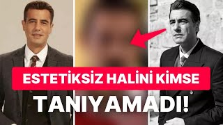 Erdal'ı Tayanç Ayaydın'ın Estetik Yaptırmadan Önceki Hali Ortaya Çıktı