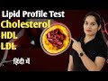 Lipid profile test  cholesterol test l ldl  what is lipid profile test  biochemistry