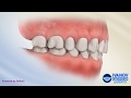 What is Normal Teeth and Bite Occlusion