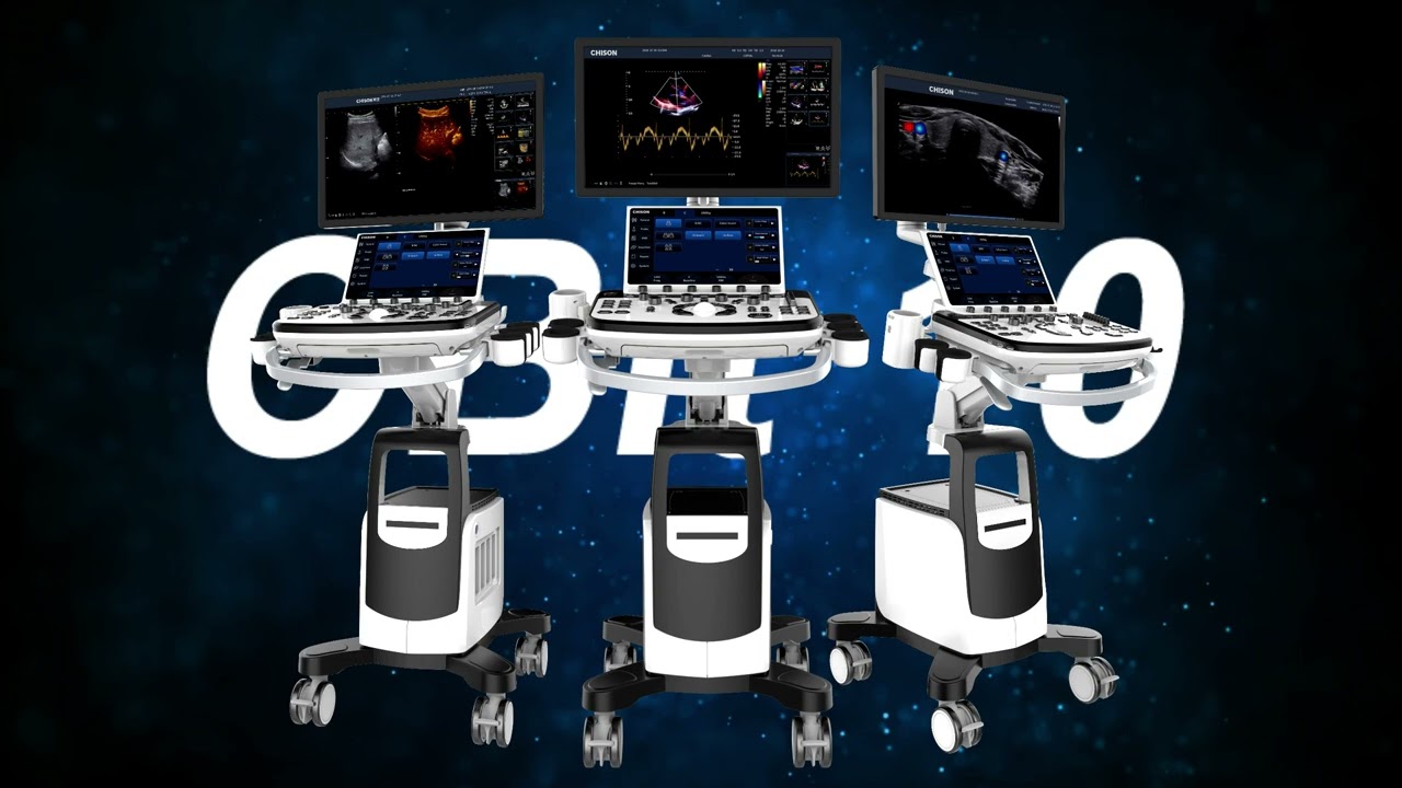Chison SonoMax Giải Pháp Siêu Âm Đỉnh Cao