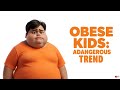 குழந்தைகள் பருமன் - அடுத்த அபாயம் செய்தி-continuing danger of childhood obesity
