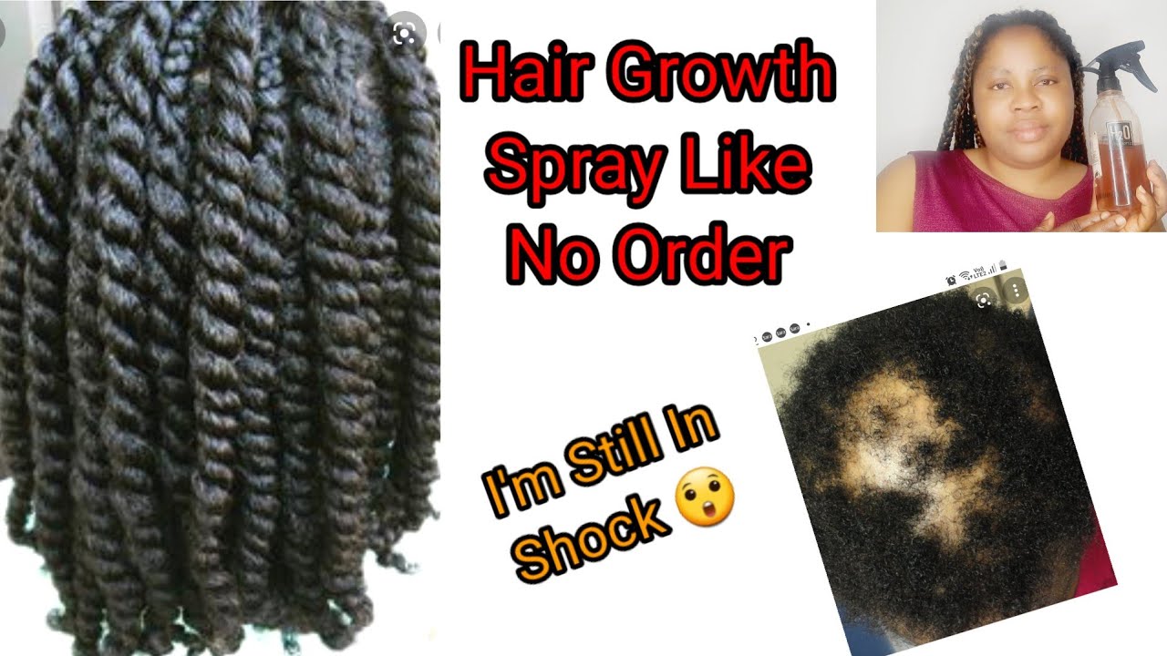 Use This Hair Growth Spray Daily And You will Be Amazed |Nancy's