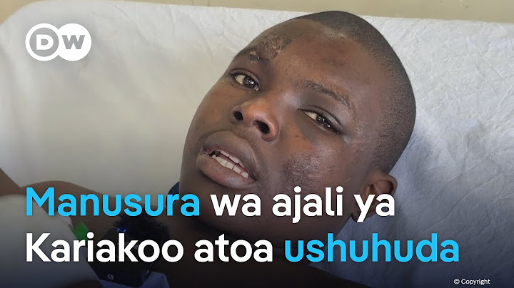 Manusura asimulia alivyookolewa ajali ya Kariakoo