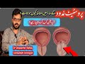 Do you have these symptoms ❓️! Prostate gland | BPH | Dr Ghazanfar Rafeq 