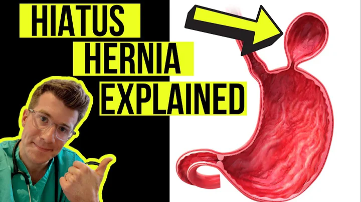 Everything you need to know about a HIATUS HERNIA | Causes, symptoms, diagnosis & treatment
