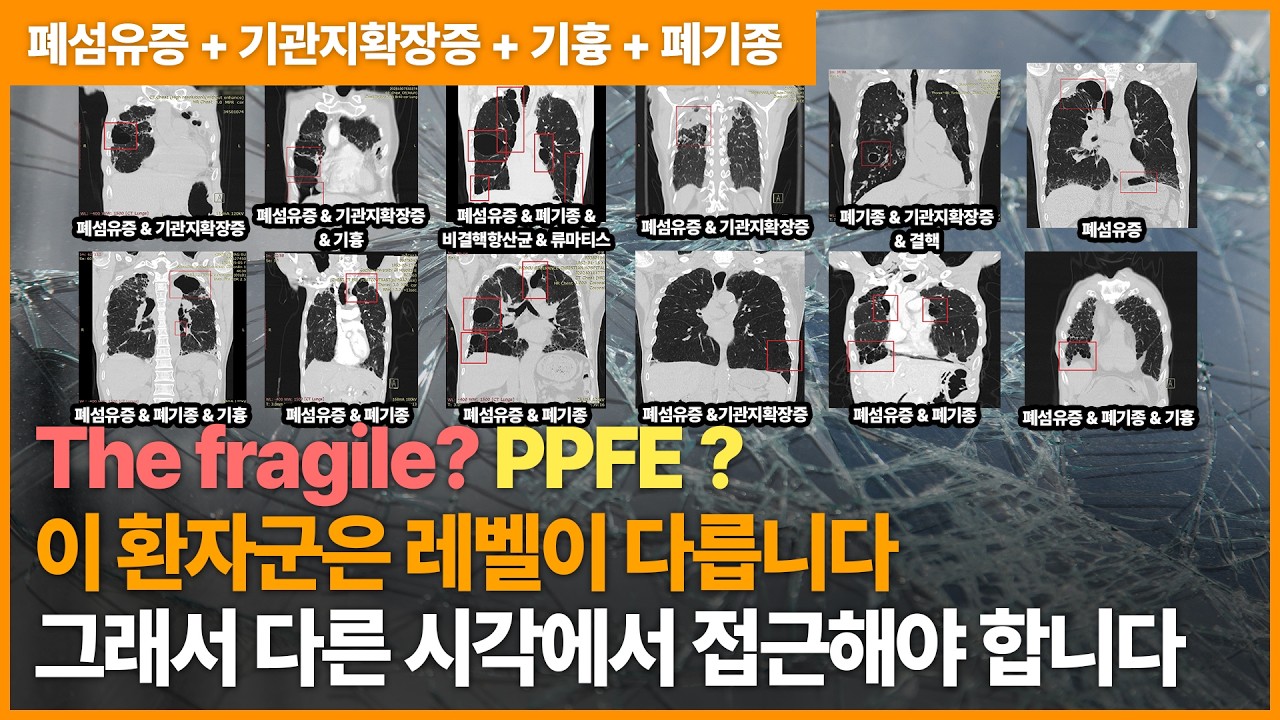 복수의 호흡기 질환이 겹친 위험한 상황. 흉막실질탄력섬유증에 대한 이해와 접근