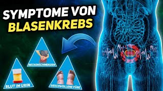 Brennt es beim Wasserlassen? - Tripper richtig behandeln (Gonorrhoe) | Urologie am Ring