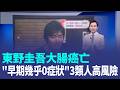【#新鮮聞報爆】東野圭吾大腸癌亡 "早期幾乎0症狀"3類人高風險 銷量超過1億冊! 日本推理小說天王東野圭吾癌逝 ｜三立新聞LIVE