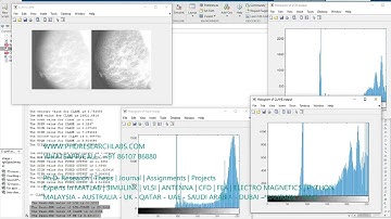 Contrast Limited Adaptive Histogram Equalization for mammography images Matlab -CLAHE-PHD RESEARCH