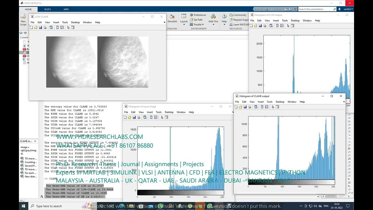 Contrast Limited Adaptive Histogram Equalization for mammography images ...