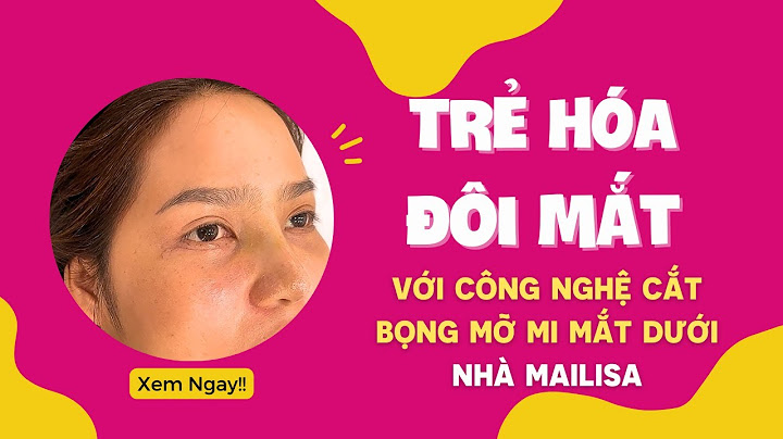 Cắt bọng mắt dưới giá bao nhiêu