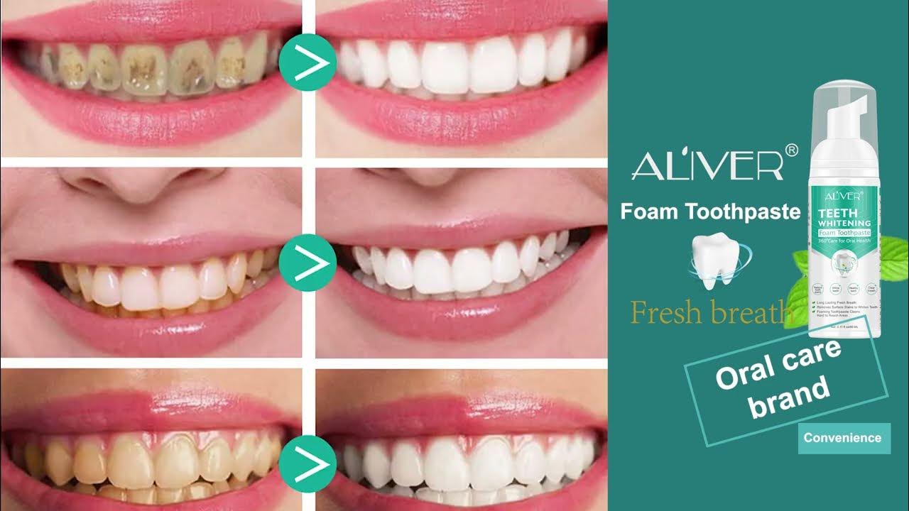 ALIVER Teeth Whitening Foam Toothpaste Smile With Confidence YouTube