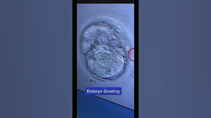 This embryo is off to a great start!!! #embryo #grades #ivf #infertility #science
