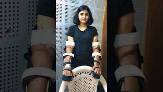 Shreya Hand Transplant