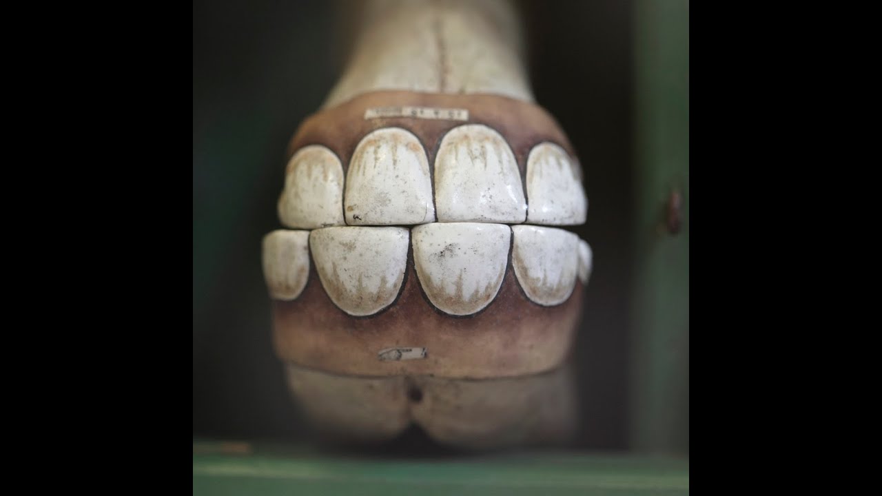 The Horses Teeth Youtube